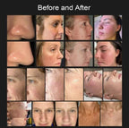 Shape Tactics 8-in-1 Hot & Cold Fusion Plasma Facial Beauty System