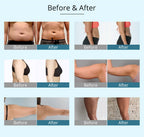 Shape Tactics 9-in-1 RF Cavitation Vacuum Body Contouring Machine